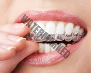 اینویزیلاین و حساسیت دندان