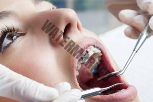 مراجعه به دندانپزشک عمومی در طول ارتودنسی