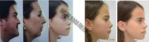 چگونه فک های کودکان ما می توانند به صورت ایده آل رشد کنند؟