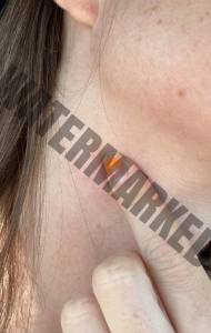 چه زمانی باید به پزشک مراجعه کرد؟
