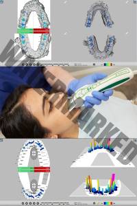 کالیبراسیون حسگر