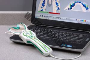 مزایای T-scan