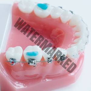 انواع بایت بلاک ها کدامند؟