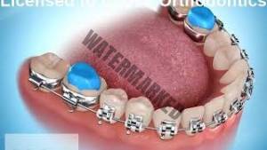 نگرانی های شایع در مورد بایت بلاک ها به همراه راه حل ها