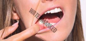 سؤالات متداول در مورد درمان ارتودنسی برای دندان های از دست رفته