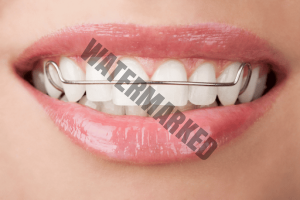 عواملی که بعد از 10 سال می توانند باعث جابجایی دندان ها شوند.