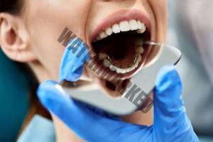 اثرات مسواک نزدن با وجود بریس ها چیست؟