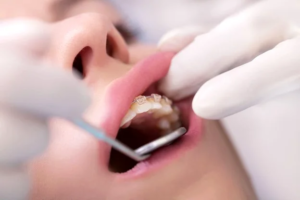 چه زمانی بهتر است برای مرحله ۲ صبر کنید؟