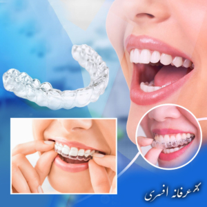 الاینرهای شفاف؛ محبوب‌ترین نسل ارتودنسی نامرئی