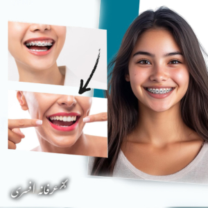 در جلسه مشاوره چه اتفاقی می‌افتد؟