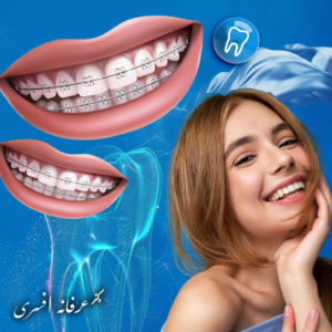مزایای ارتودنسی در بزرگسالی