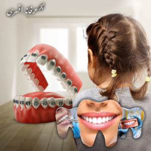 چگونه بهترین متخصص ارتودنسی در رشت را انتخاب کنیم؟