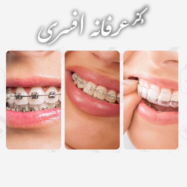شلوغی و بی‌نظمی دندان‌ها؛ وقتی لبخند فضای کافی ندارد