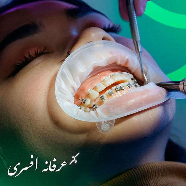 بهترین متخصص ارتودنسی بزرگسالان در رشت