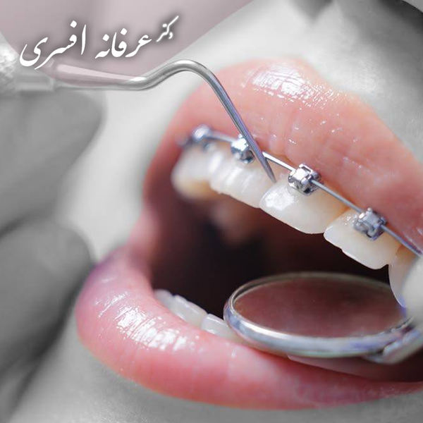 مراقبت‌های مهم در طول درمان ارتودنسی بزرگسالان