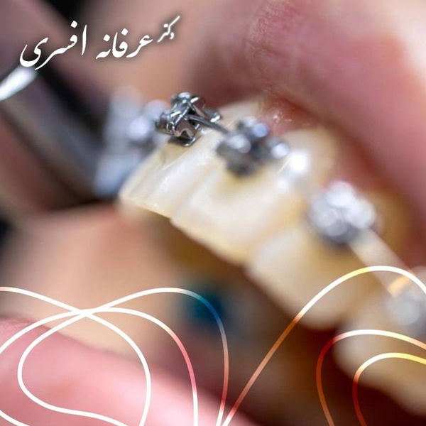 نوبت مشاوره ارتودنسی بزرگسالان در رشت